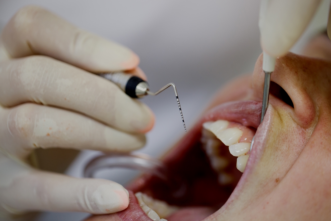 Ritrattamenti ortodontici per adulti: correggi recidive, nuovi spostamenti e preparati a riabilitazioni estetiche con soluzioni moderne e personalizzate a Lugano. Ritrattamenti ortodontici per adulti: correggi recidive, nuovi spostamenti e preparati a riabilitazioni estetiche con soluzioni moderne e personalizzate a Lugano.
