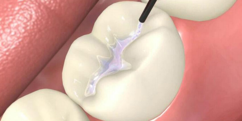 Trattamenti Estetici Multidisciplinari per Adulti a Lugano | Studio Bakaj