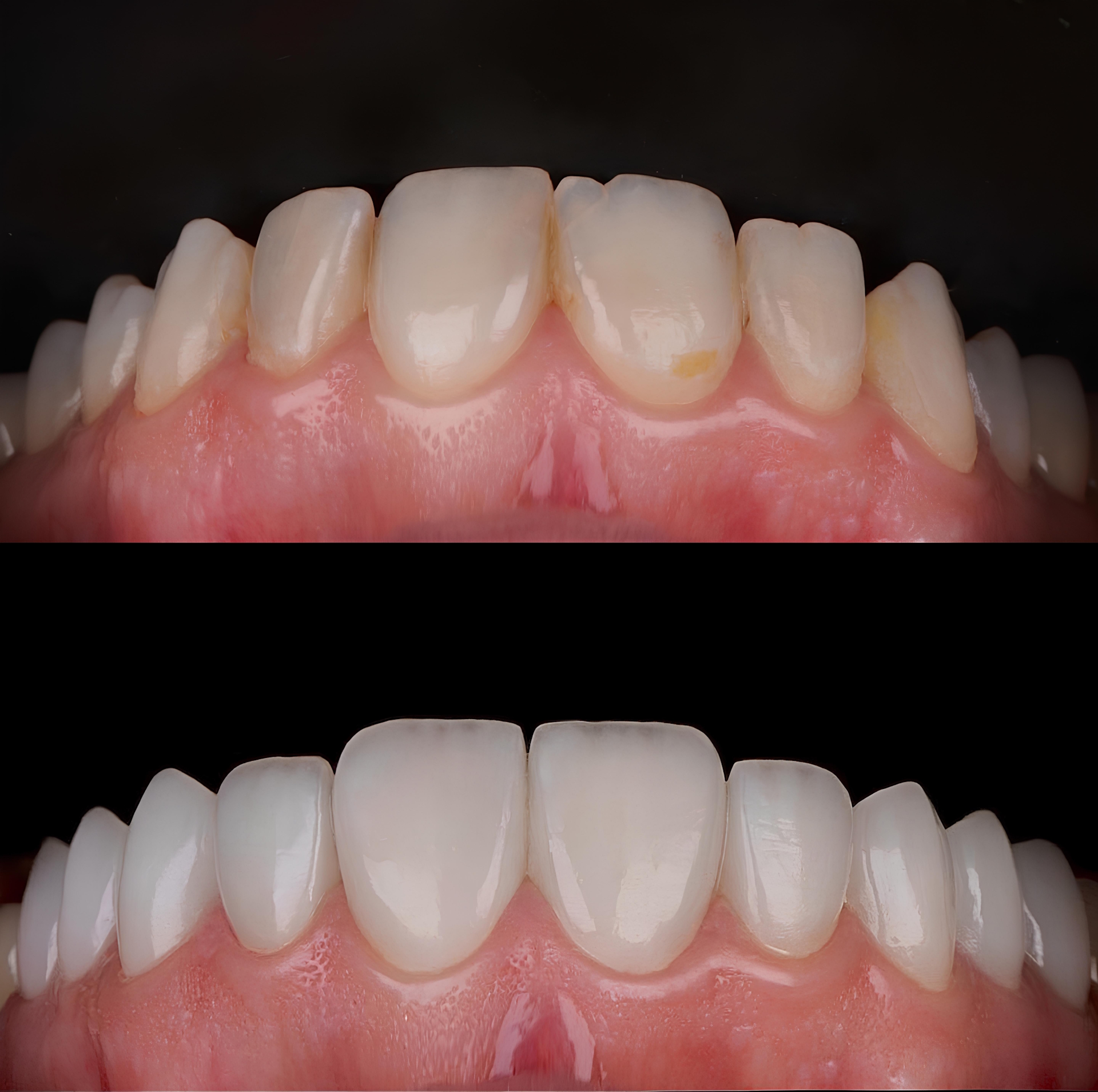 Trattamenti Estetici Multidisciplinari per Adulti a Lugano | Studio Bakaj Trattamenti Estetici Multidisciplinari per Adulti a Lugano | Studio Bakaj
